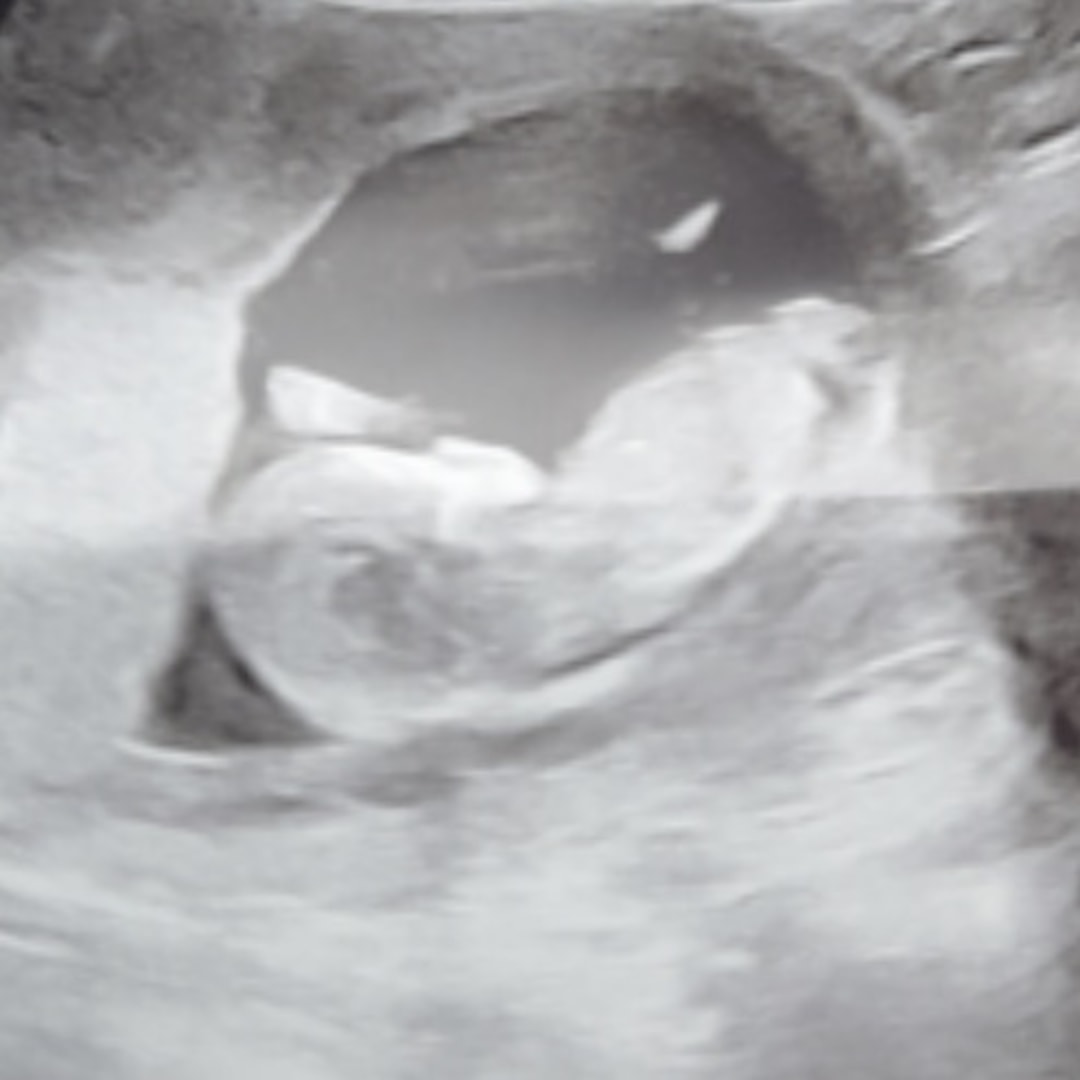 Photo shared by Emily for their Babylist baby registry.