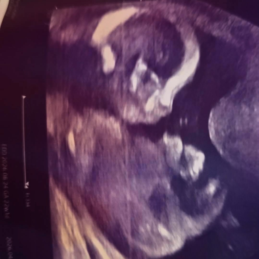 Photo shared by Heather for their Babylist baby registry.