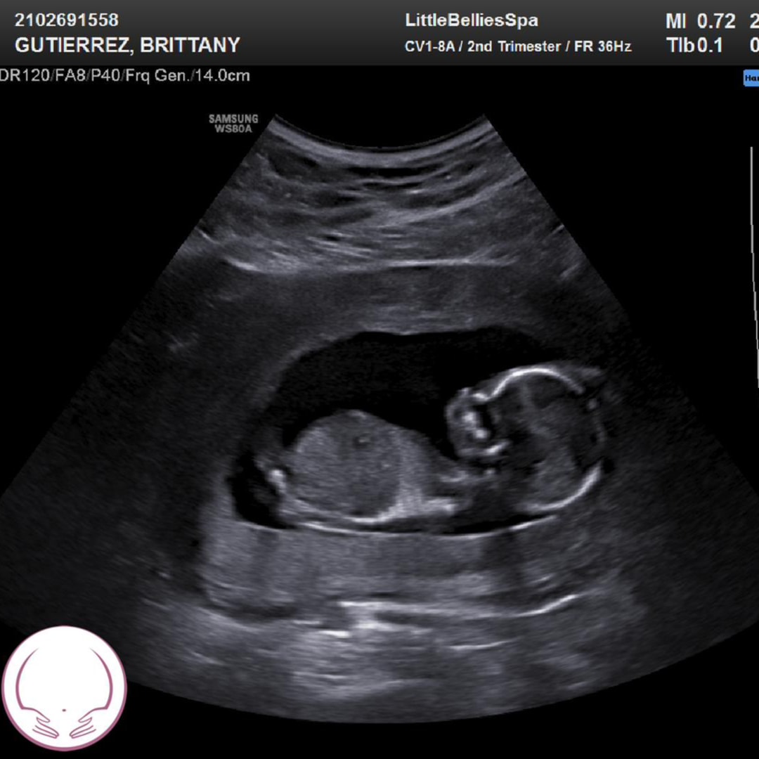 Photo shared by Brittany for their Babylist baby registry.