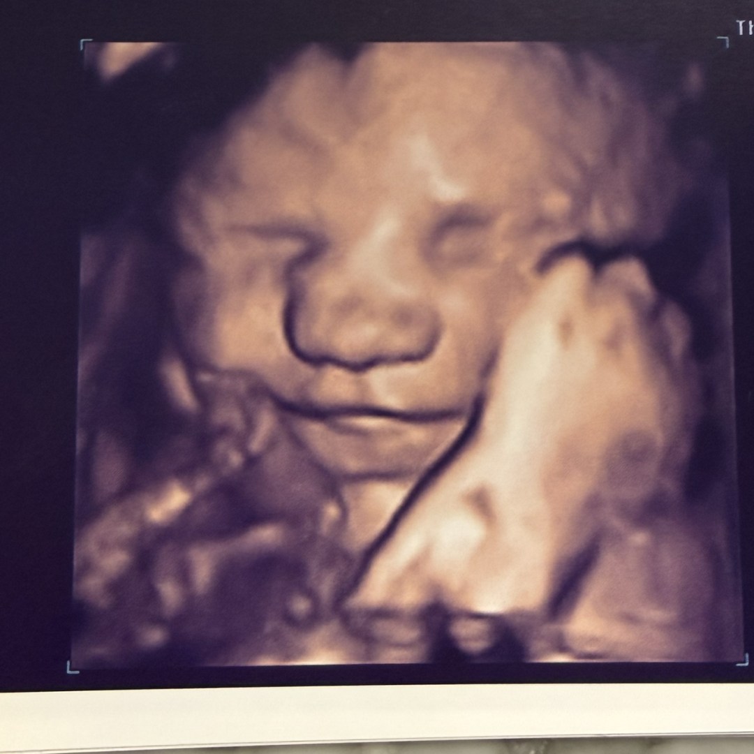 Photo shared by Christine for their Babylist baby registry.