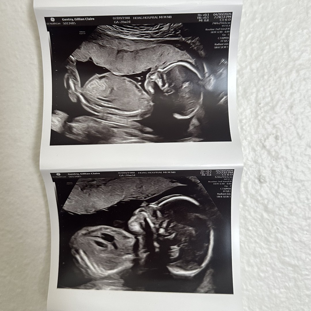 Photo shared by Gillian for their Babylist baby registry.
