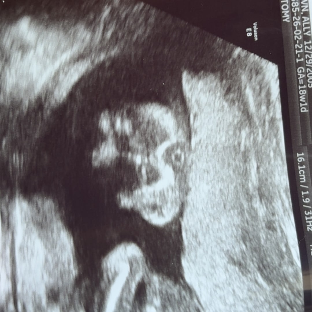 Photo shared by Ally for their Babylist baby registry.