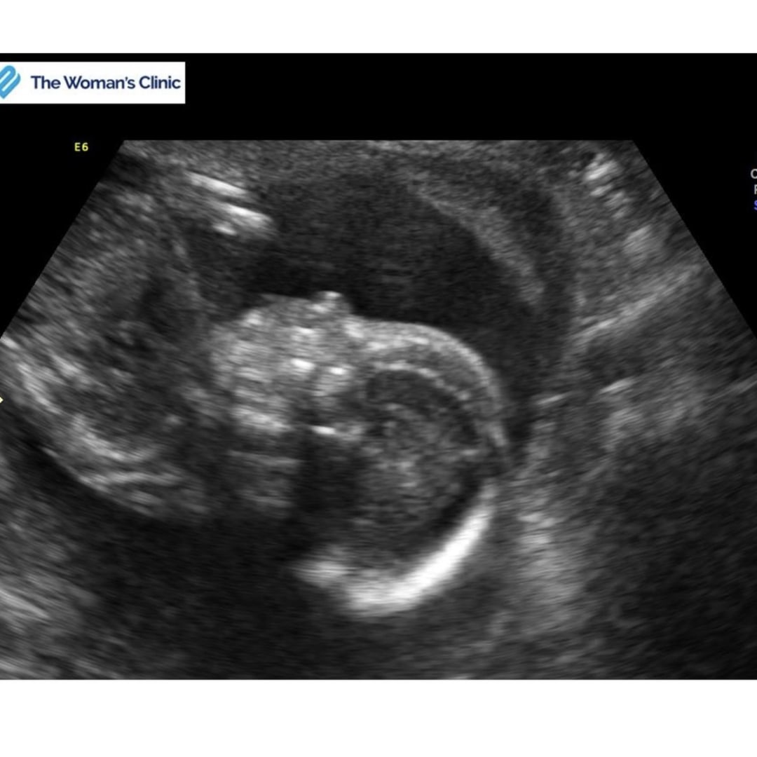 Photo shared by Tressie for their Babylist baby registry.