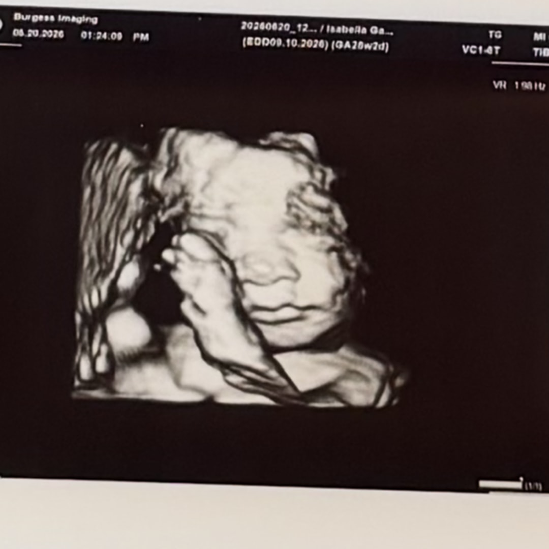 Photo shared by Isabella for their Babylist baby registry.
