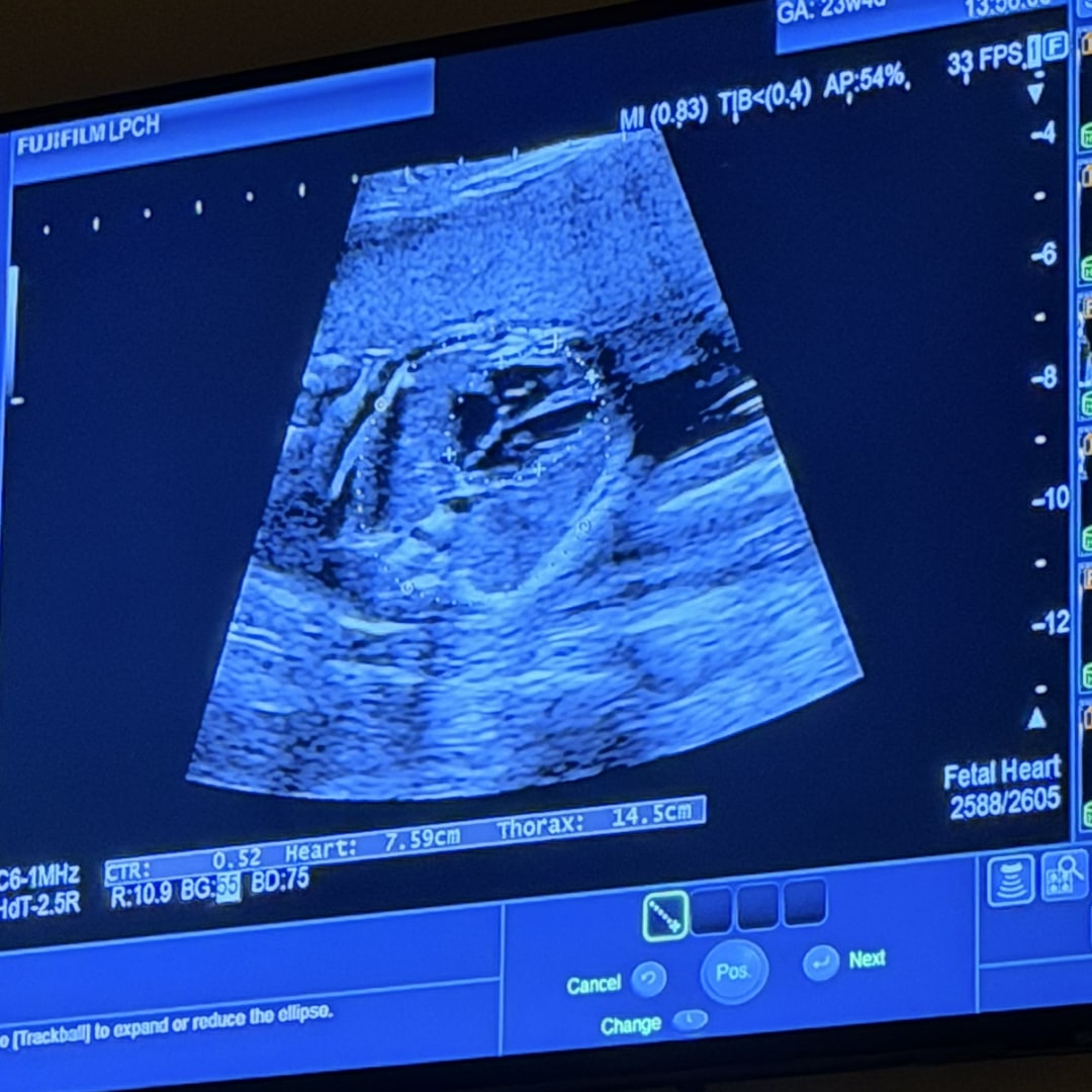 Photo shared by Marybeth for their Babylist baby registry.