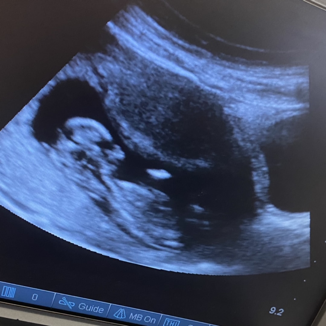 Photo shared by Divinity for their Babylist baby registry.