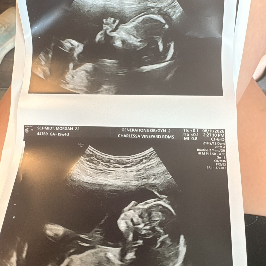 Photo shared by Morgan for their Babylist baby registry.