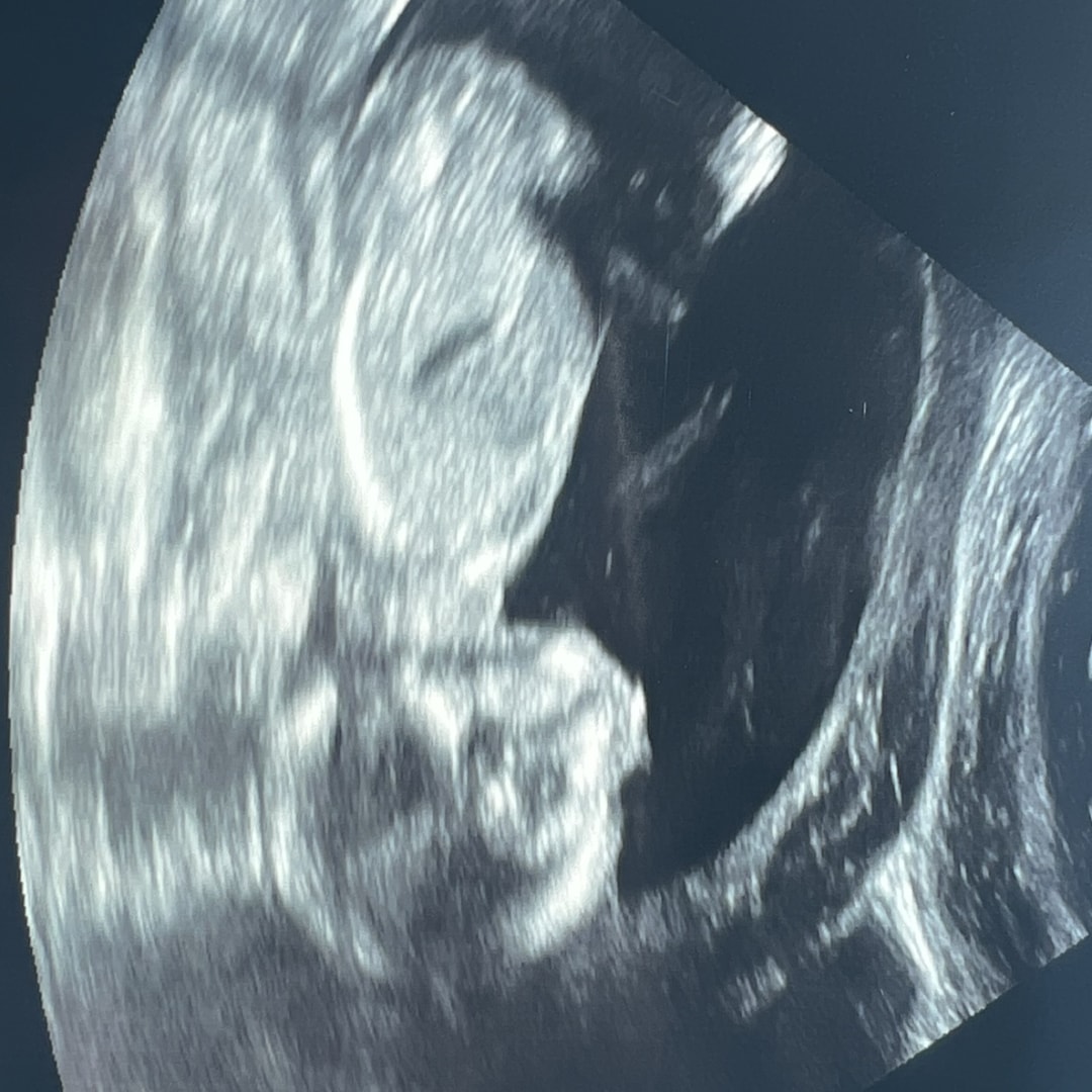 Photo shared by Bryce for their Babylist baby registry.