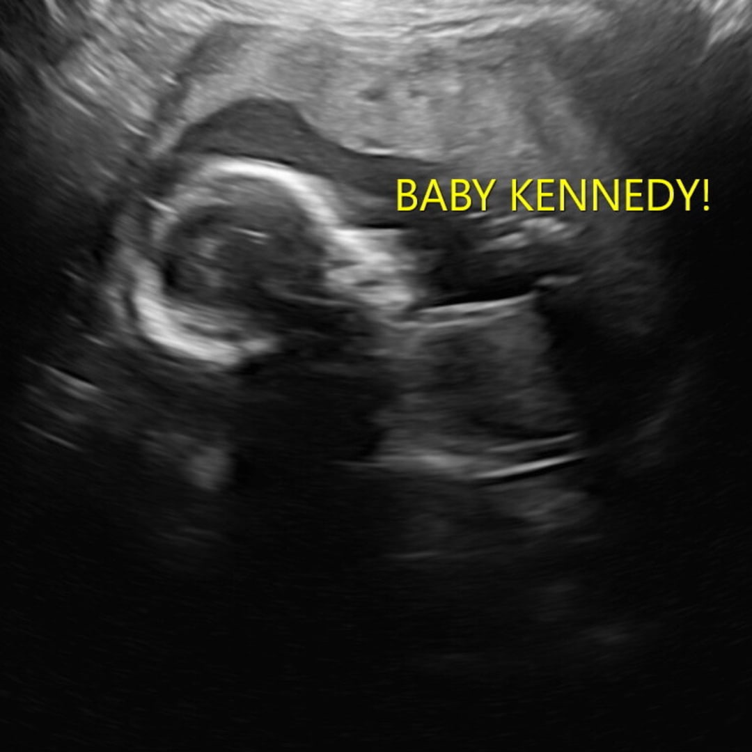 Photo shared by Ali for their Babylist baby registry.