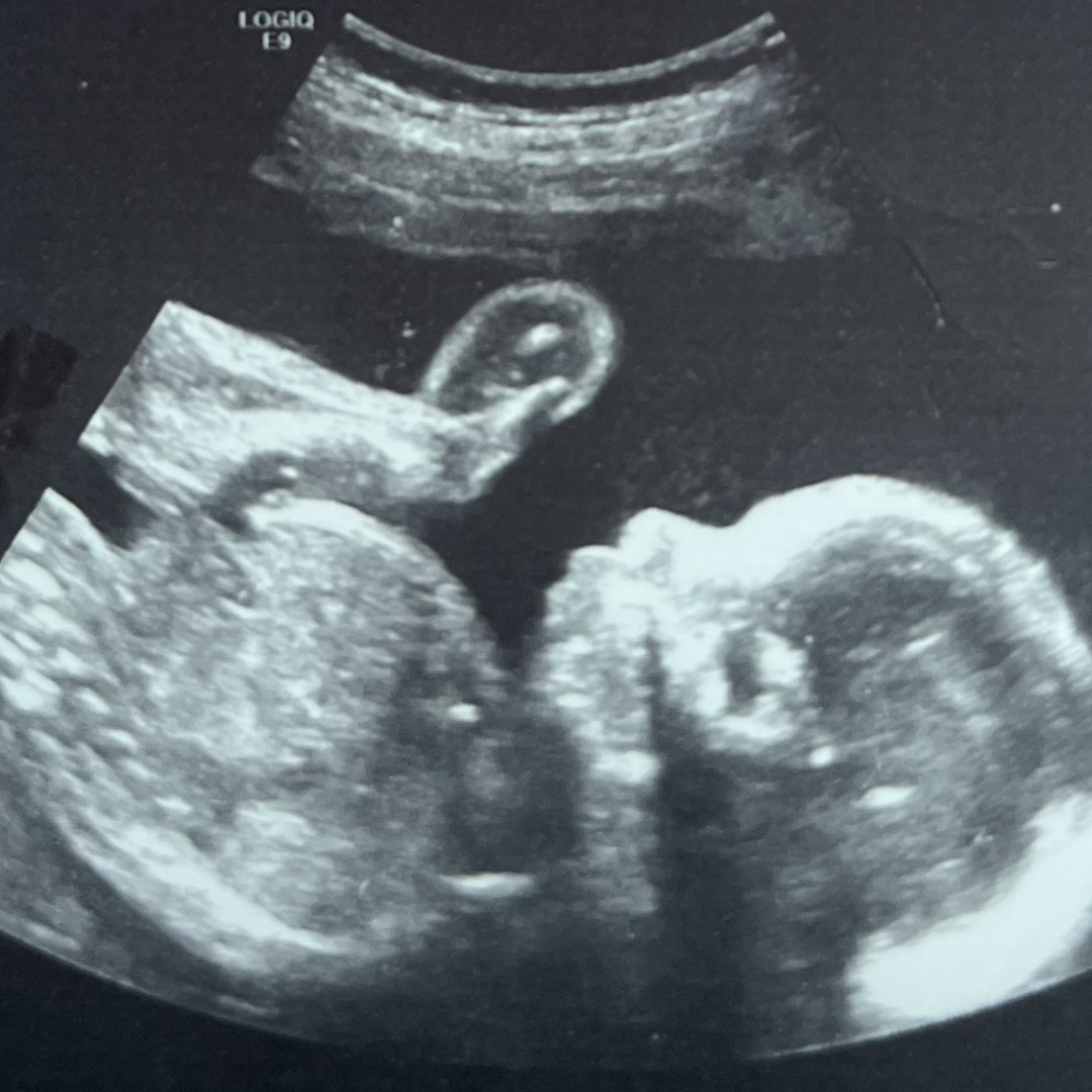 Photo shared by Heather for their Babylist baby registry.