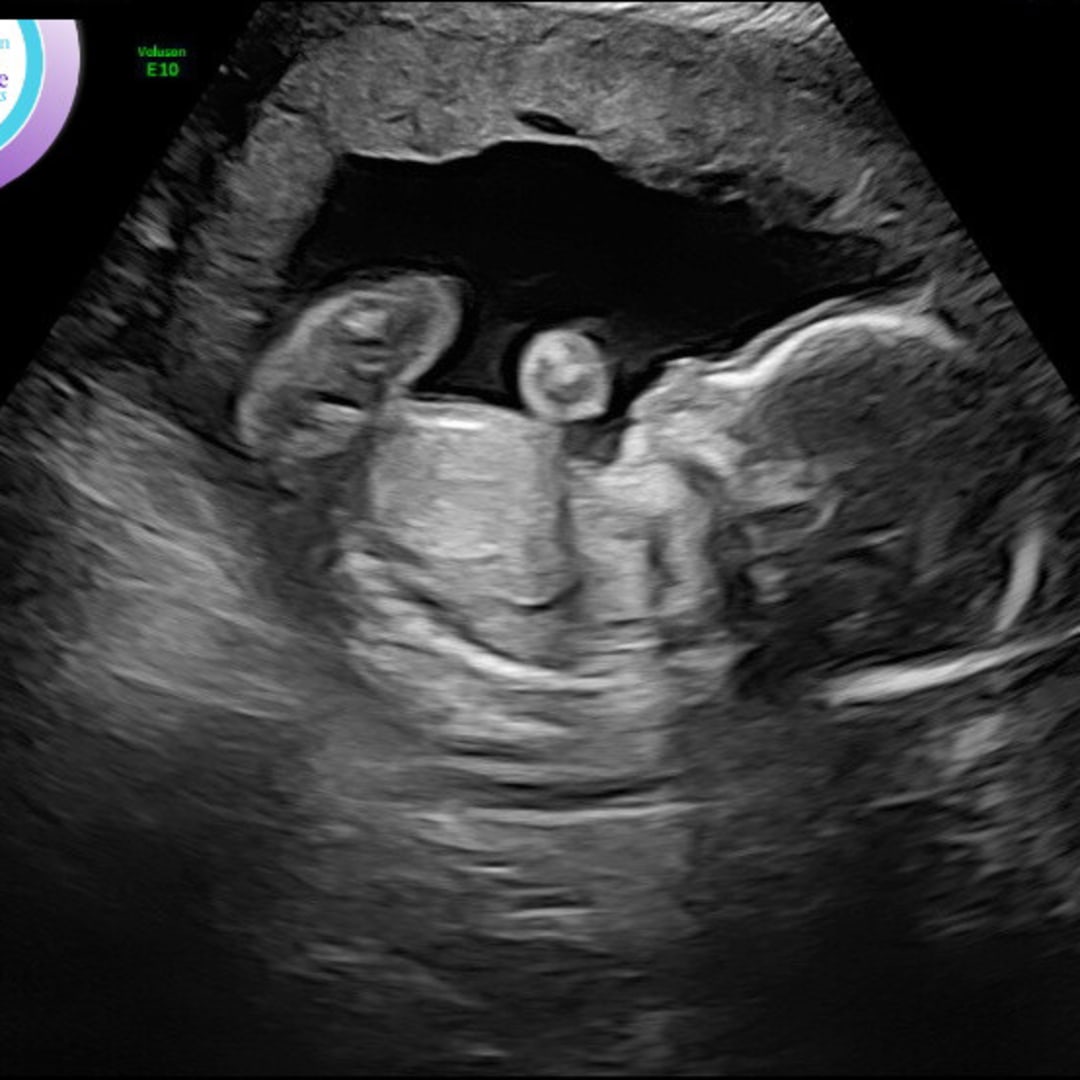 Photo shared by Maegan for their Babylist baby registry.