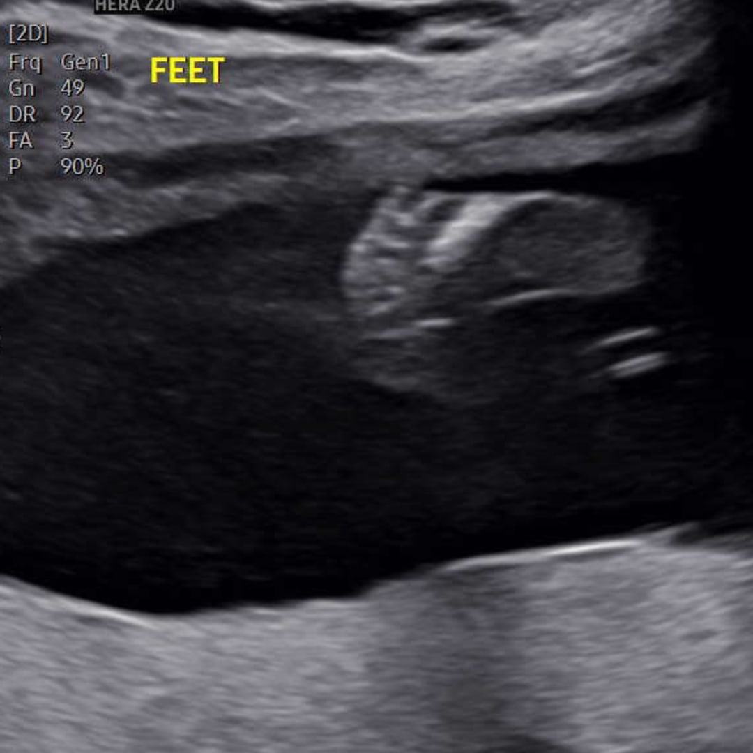 Photo shared by Hannah-Ireland for their Babylist baby registry.