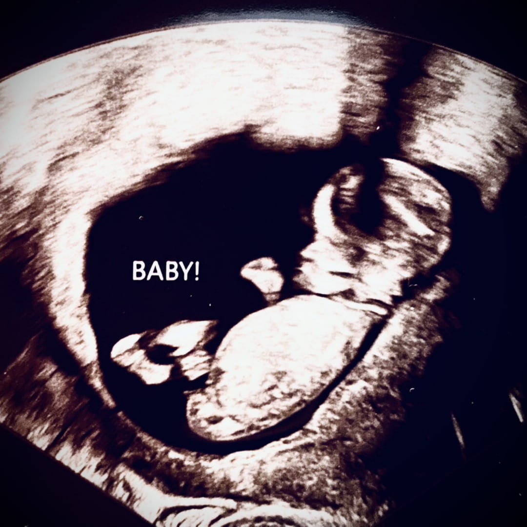 Photo shared by Eliza for their Babylist baby registry.