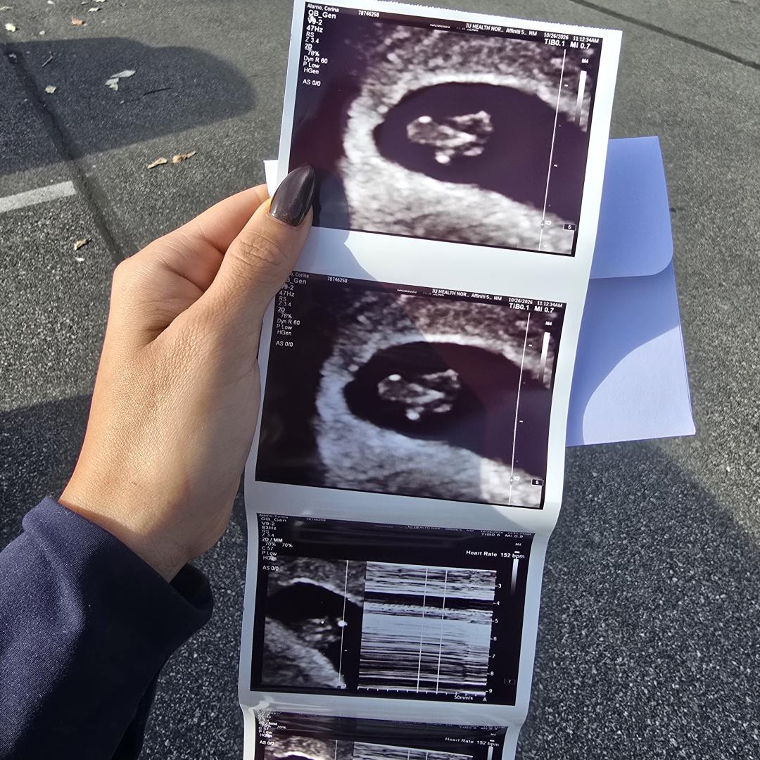 Photo shared by Corina alamo for their Babylist baby registry.