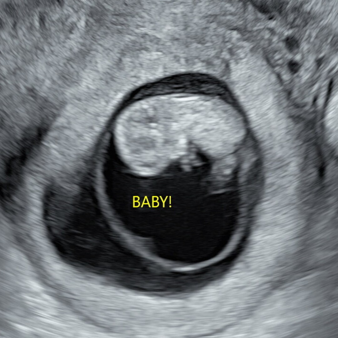 Photo shared by Britni for their Babylist baby registry.