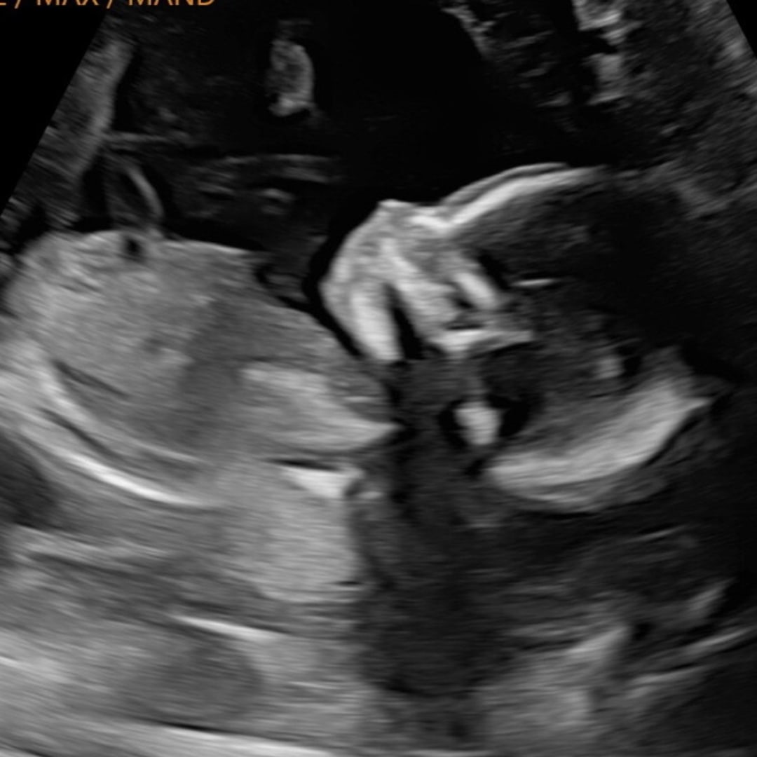 Photo shared by Macey for their Babylist baby registry.