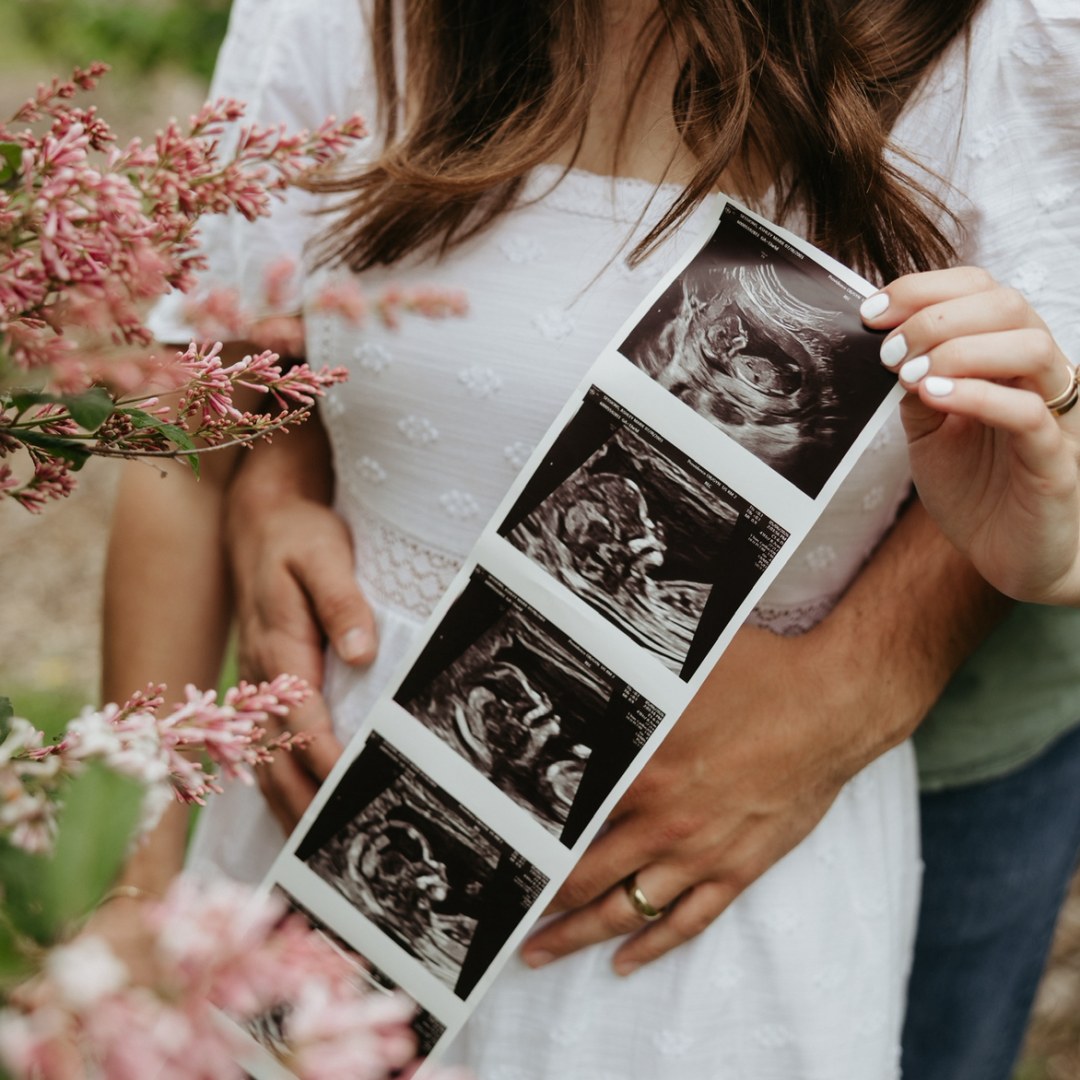 Photo shared by Ashley for their Babylist baby registry.