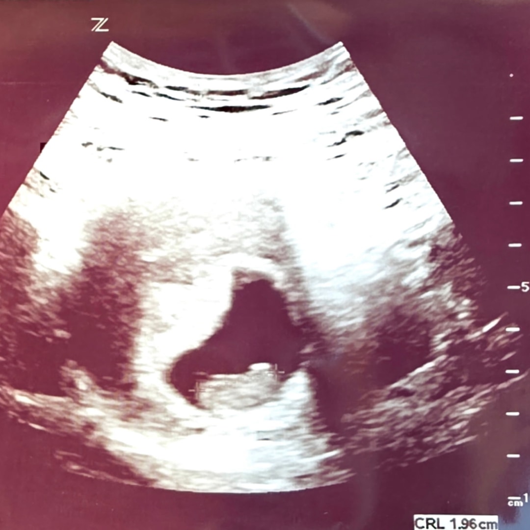 Photo shared by Alina for their Babylist baby registry.