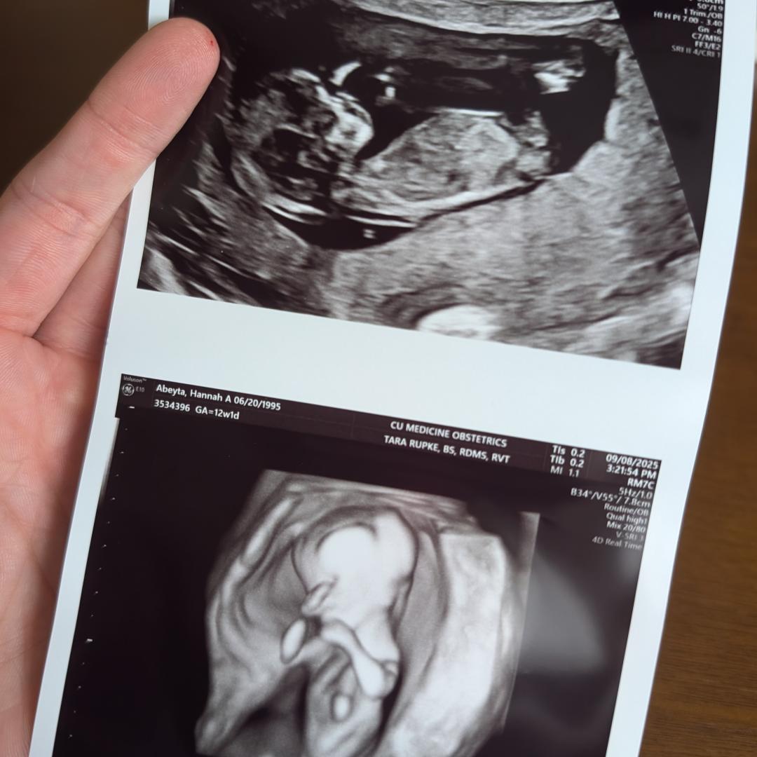 Photo shared by Hannah for their Babylist baby registry.