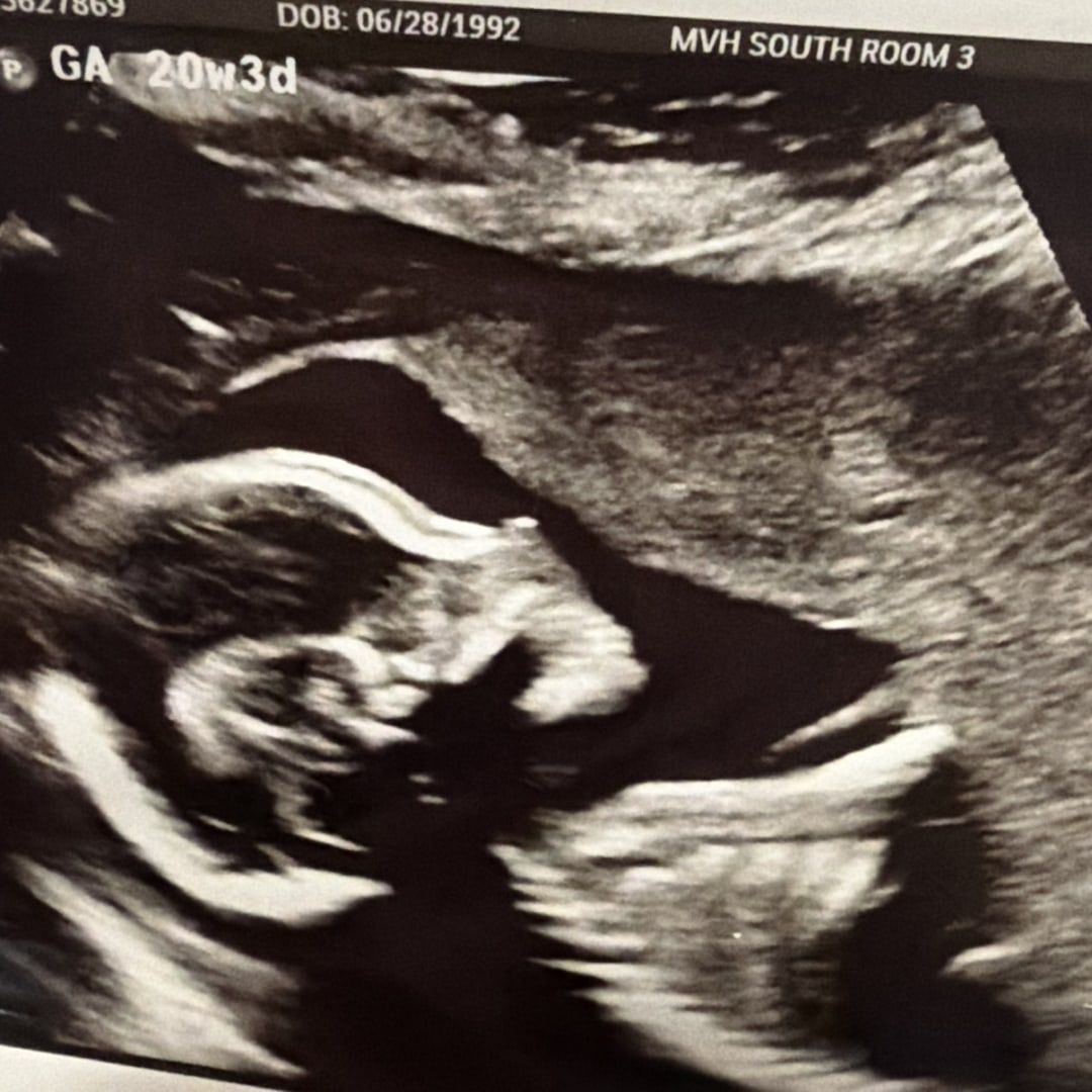 Photo shared by Becca for their Babylist baby registry.