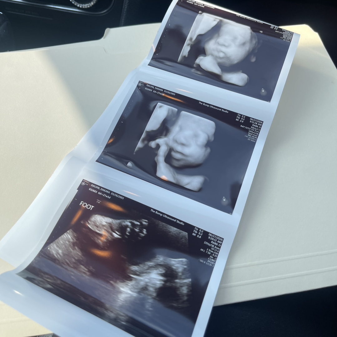 Photo shared by Dakara for their Babylist baby registry.