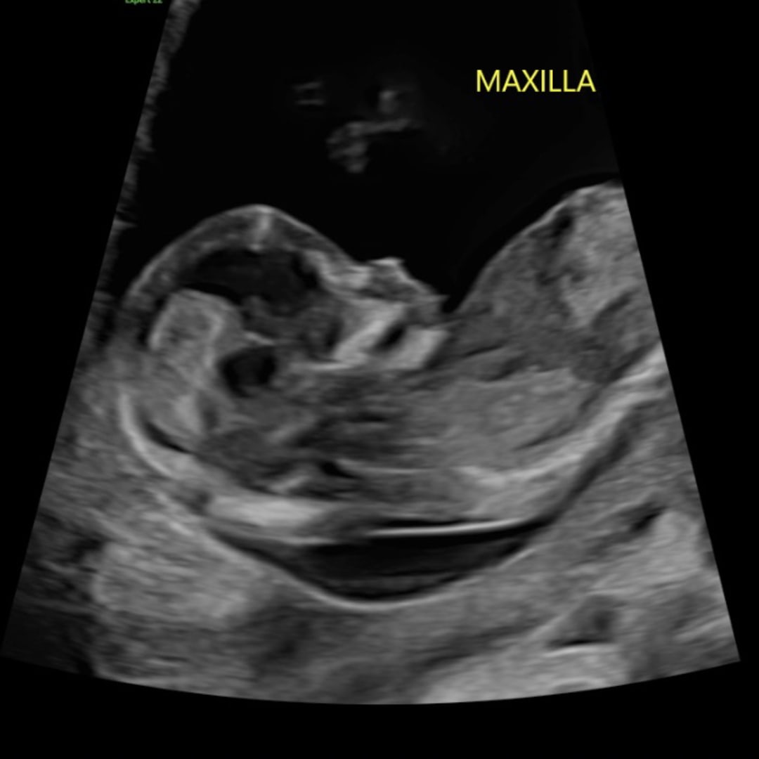Photo shared by Kyana for their Babylist baby registry.