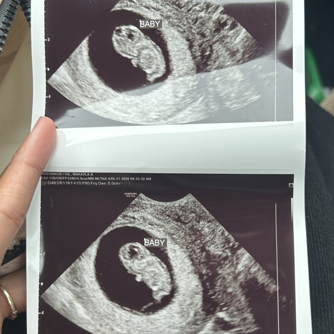 Photo shared by Makayla for their Babylist baby registry.
