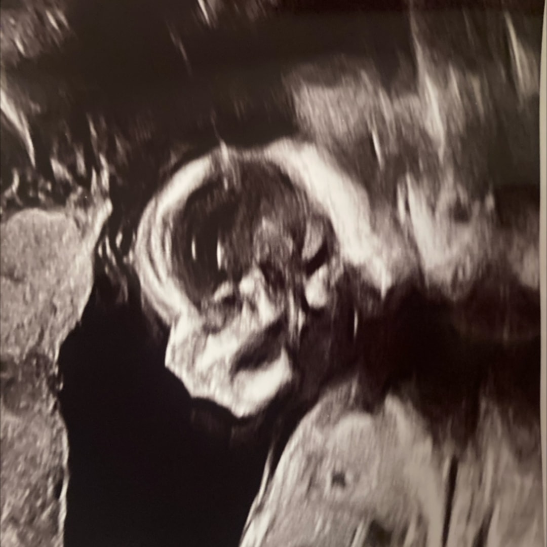 Photo shared by Laura for their Babylist baby registry.