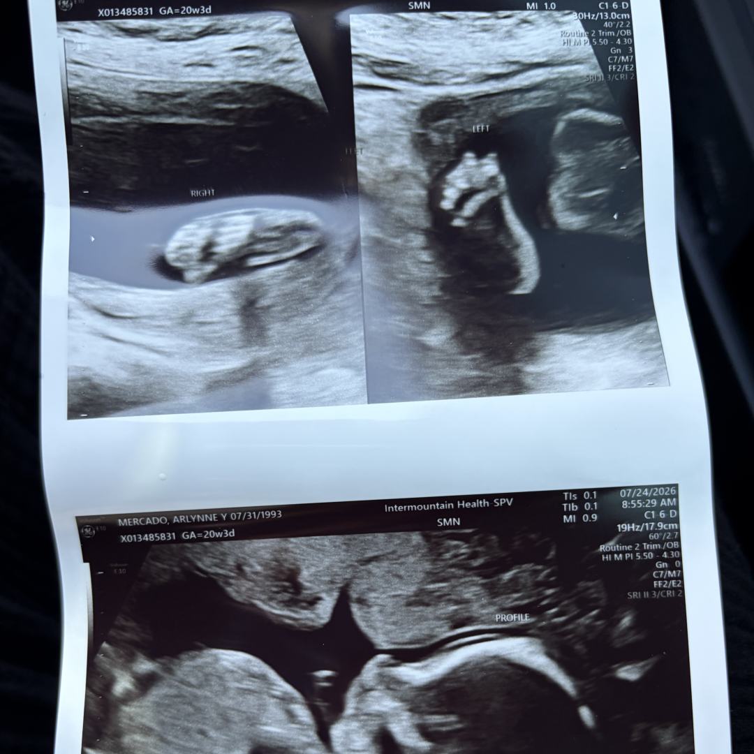 Photo shared by Arlynne for their Babylist baby registry.
