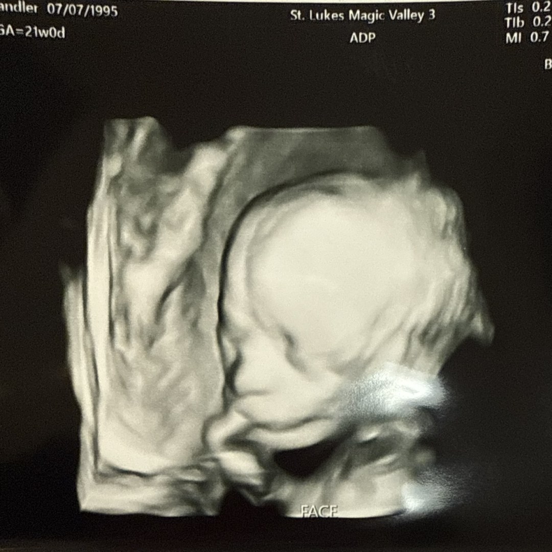 Photo shared by Chandler for their Babylist baby registry.