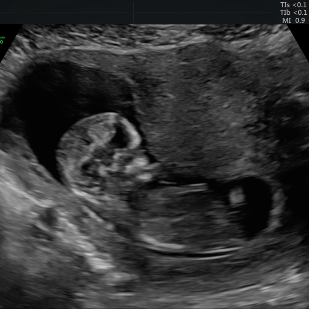 Photo shared by Alyssa for their Babylist baby registry.