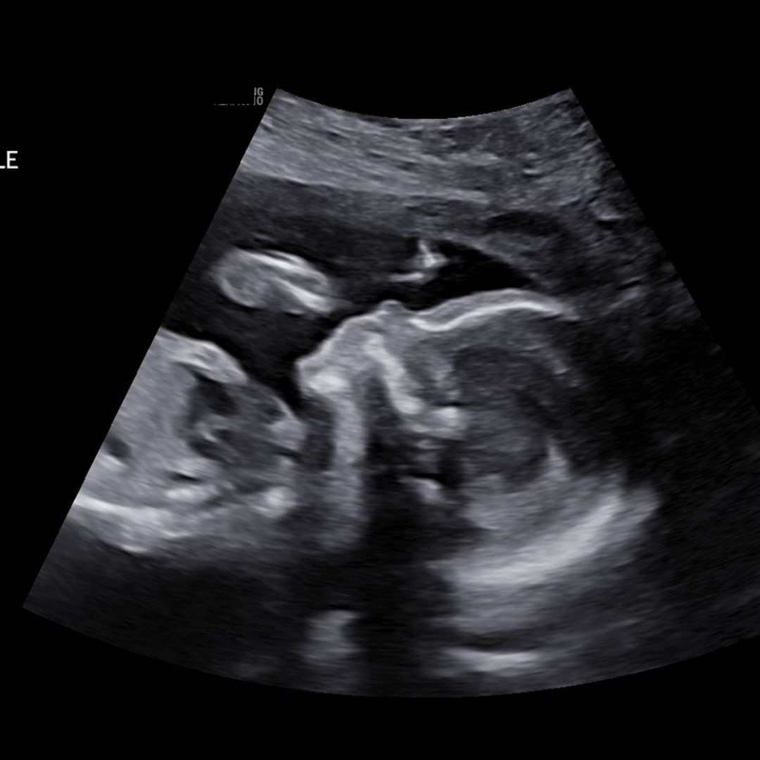 Photo shared by Amanda for their Babylist baby registry.