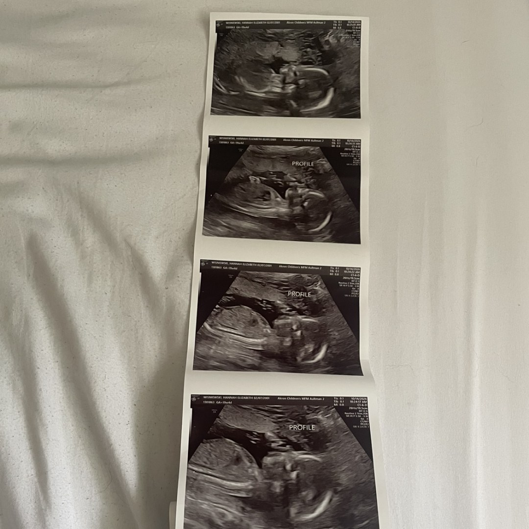 Photo shared by Hannah for their Babylist baby registry.