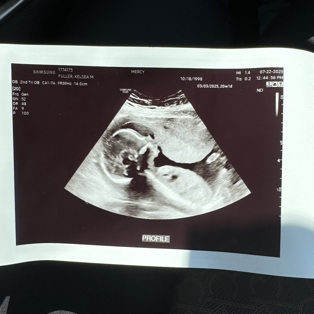 Photo shared by Kelsea for their Babylist baby registry.