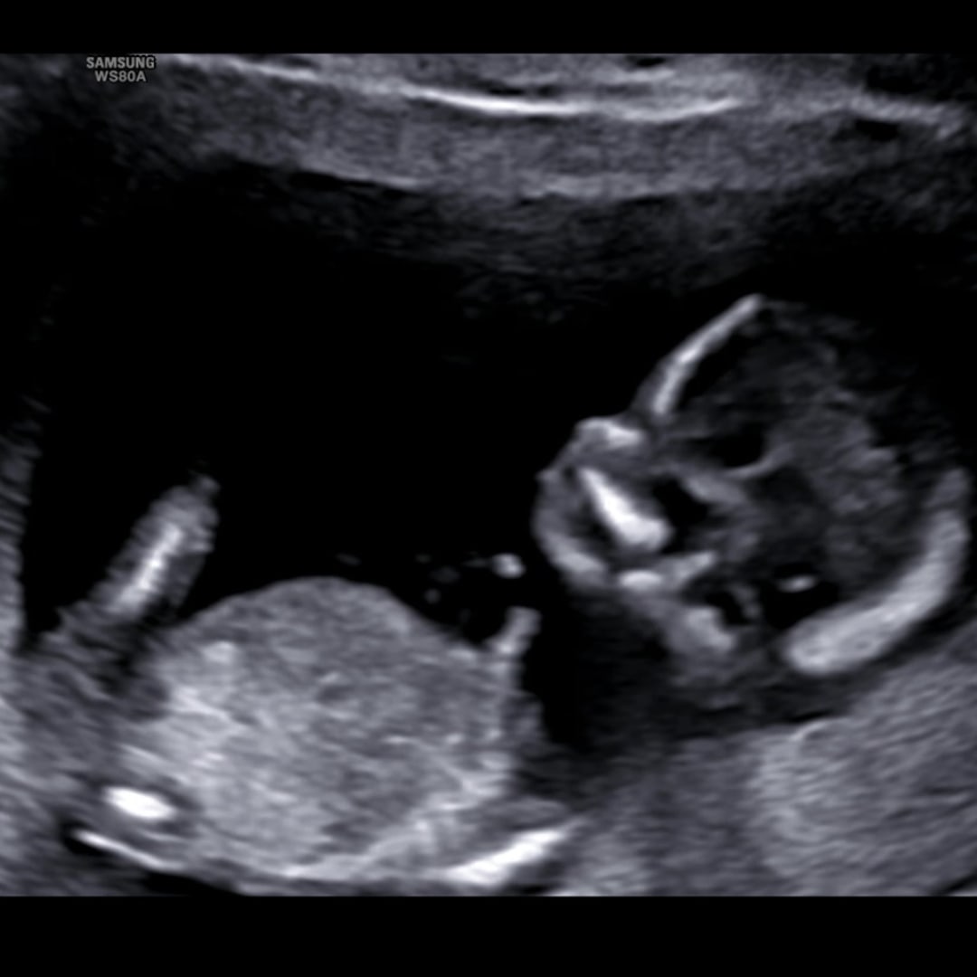 Photo shared by Aubrey for their Babylist baby registry.