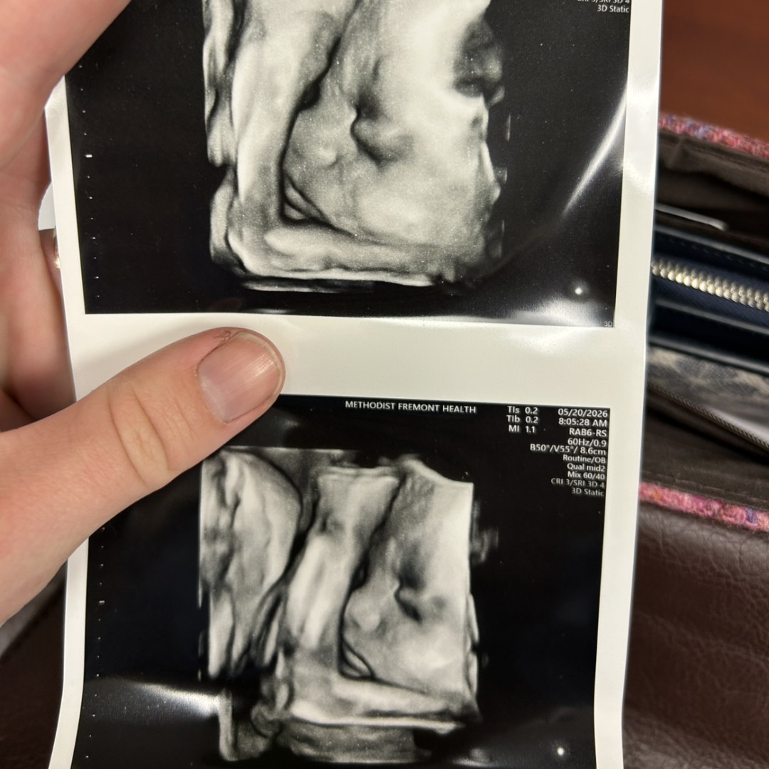 Photo shared by Emma for their Babylist baby registry.
