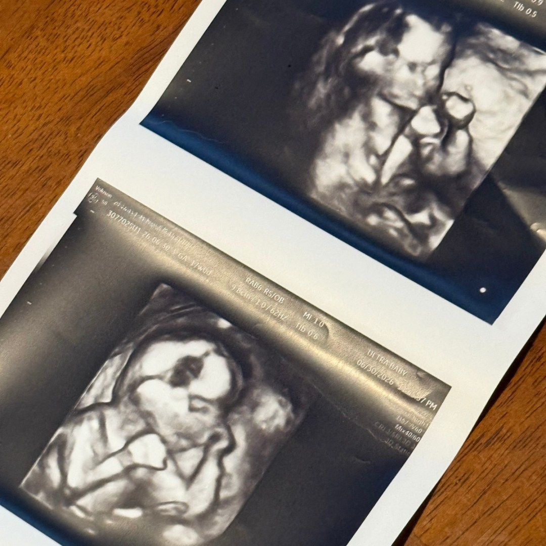 Photo shared by Monica for their Babylist baby registry.