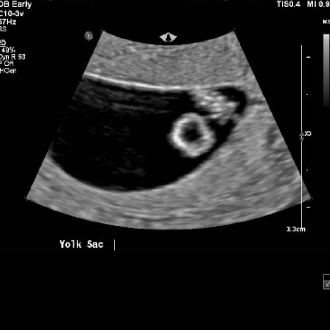 Photo shared by Joanna for their Babylist baby registry.