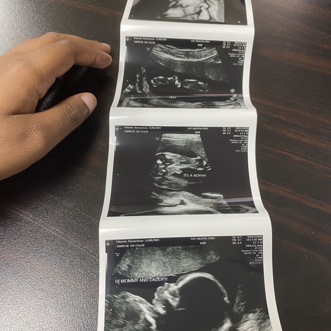 Photo shared by Damareiona for their Babylist baby registry.