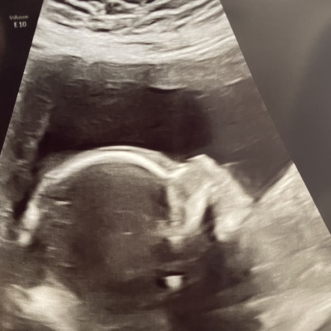 Photo shared by Nichelle for their Babylist baby registry.