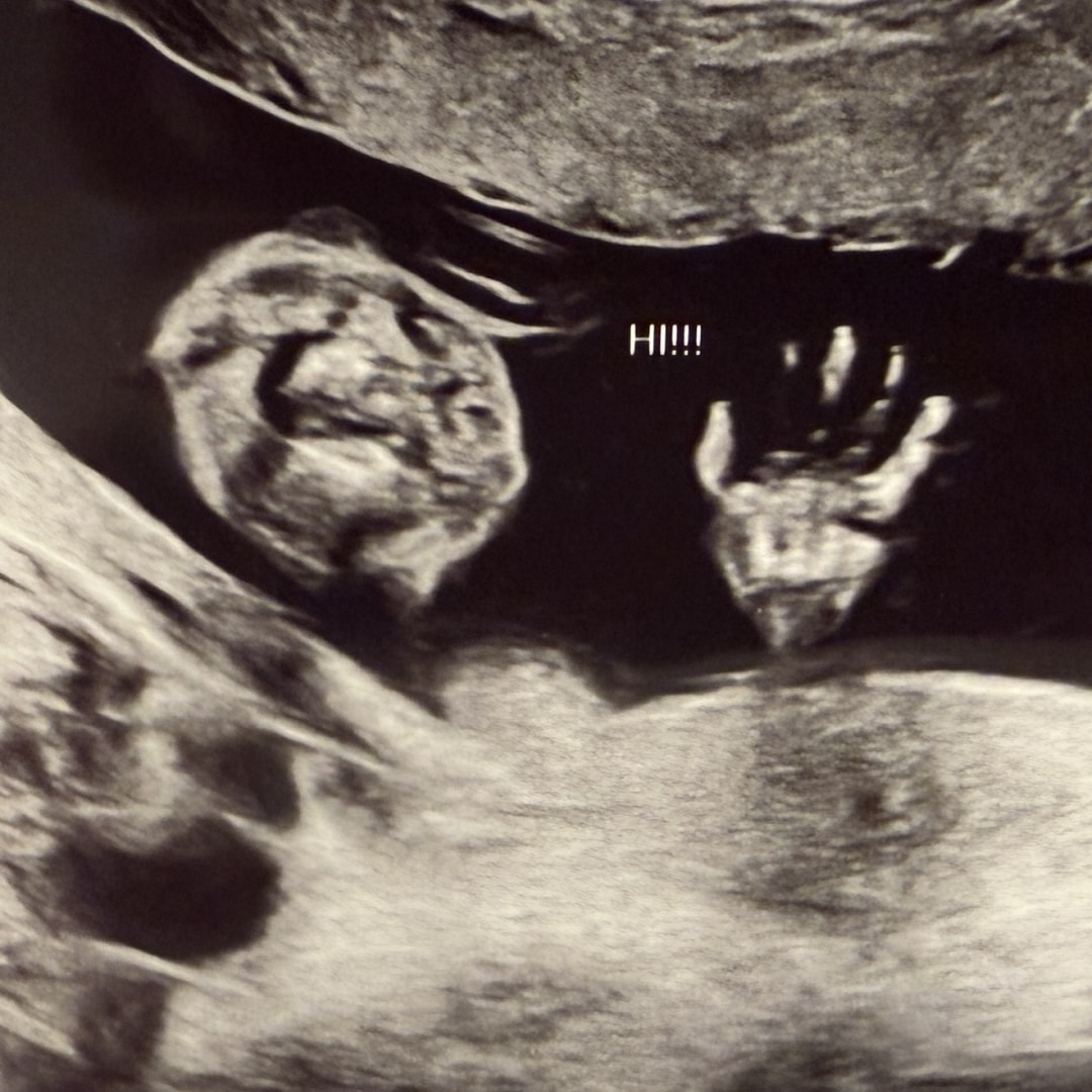 Photo shared by Anna for their Babylist baby registry.