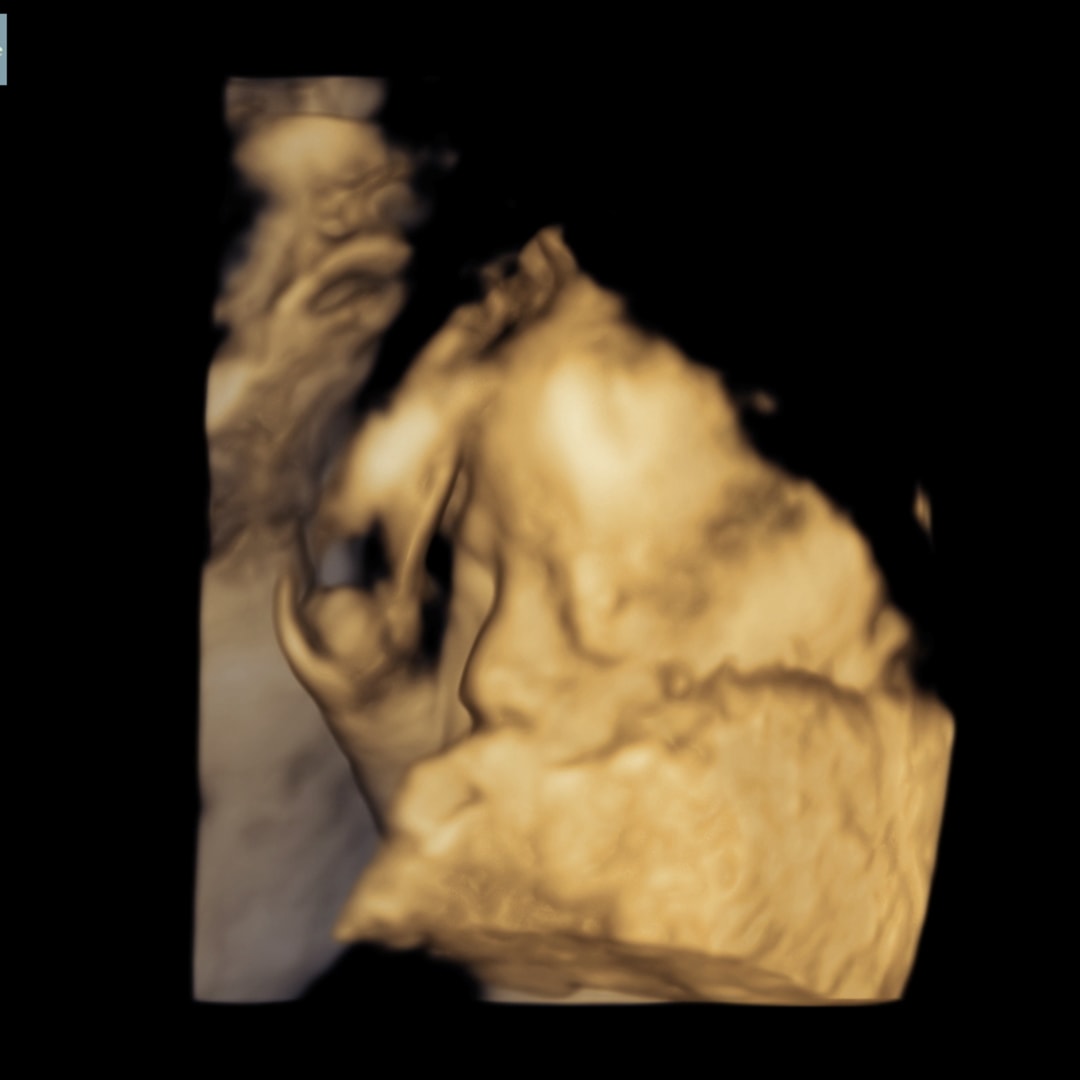 Photo shared by Kimberly for their Babylist baby registry.