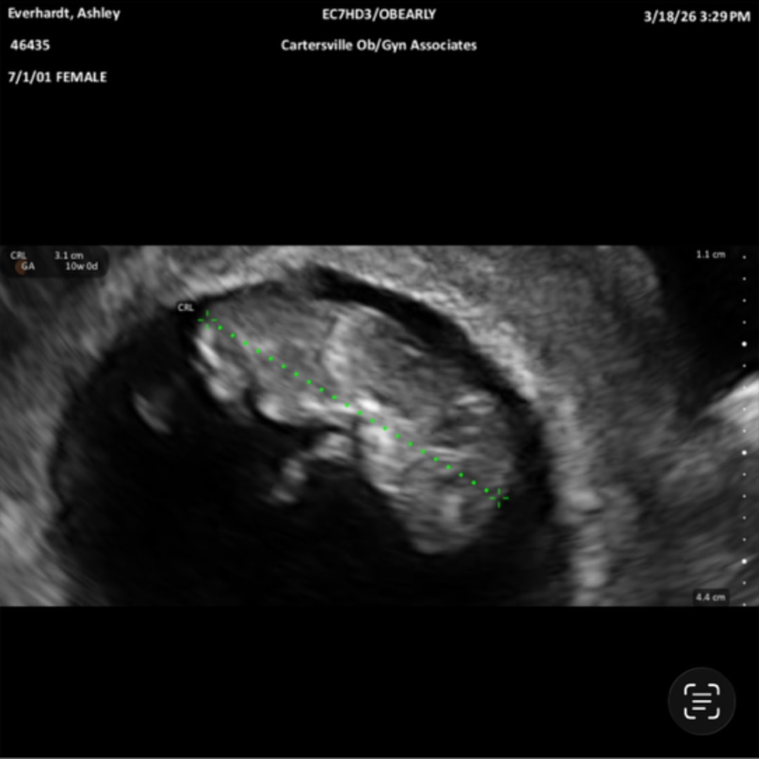 Photo shared by Ashley for their Babylist baby registry.