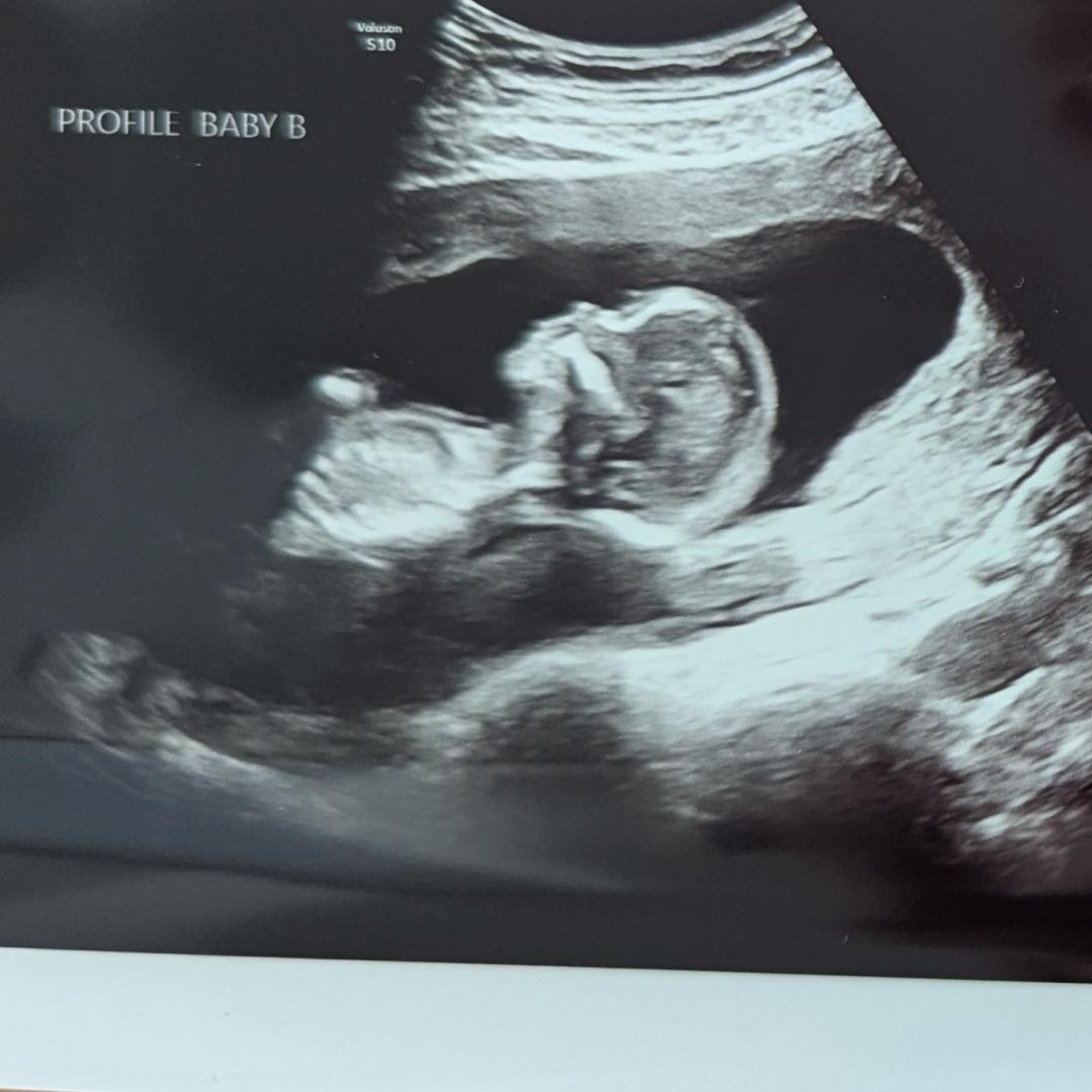 Photo shared by Heather for their Babylist baby registry.