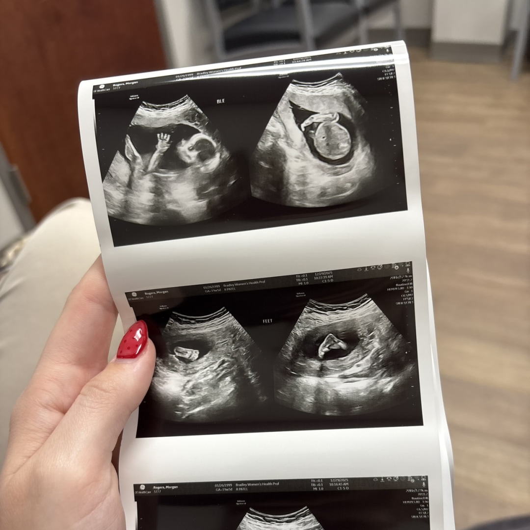 Photo shared by Morgan for their Babylist baby registry.