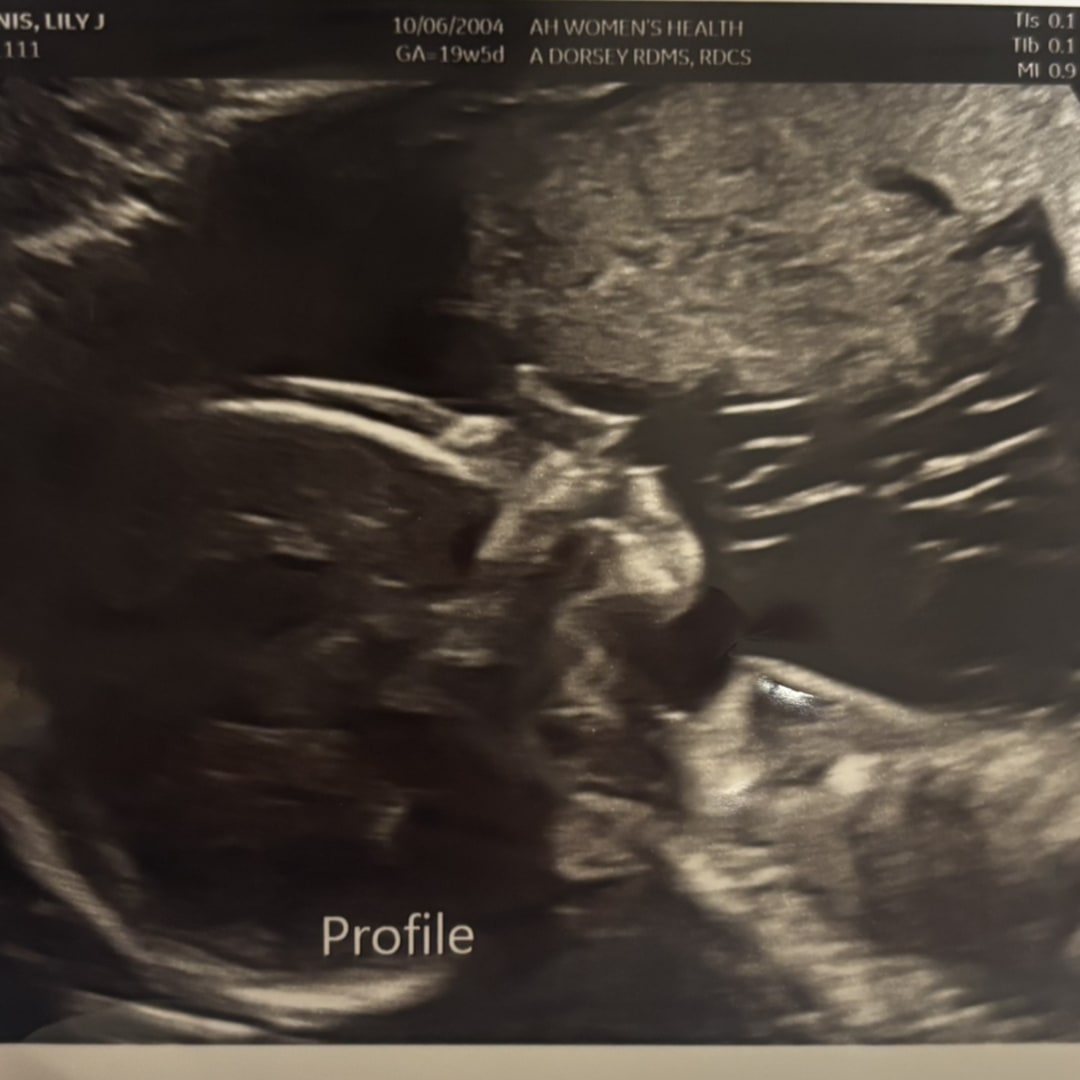 Photo shared by Lily for their Babylist baby registry.