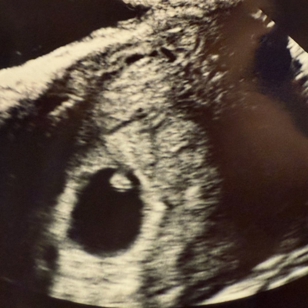 Photo shared by Elizabeth for their Babylist baby registry.