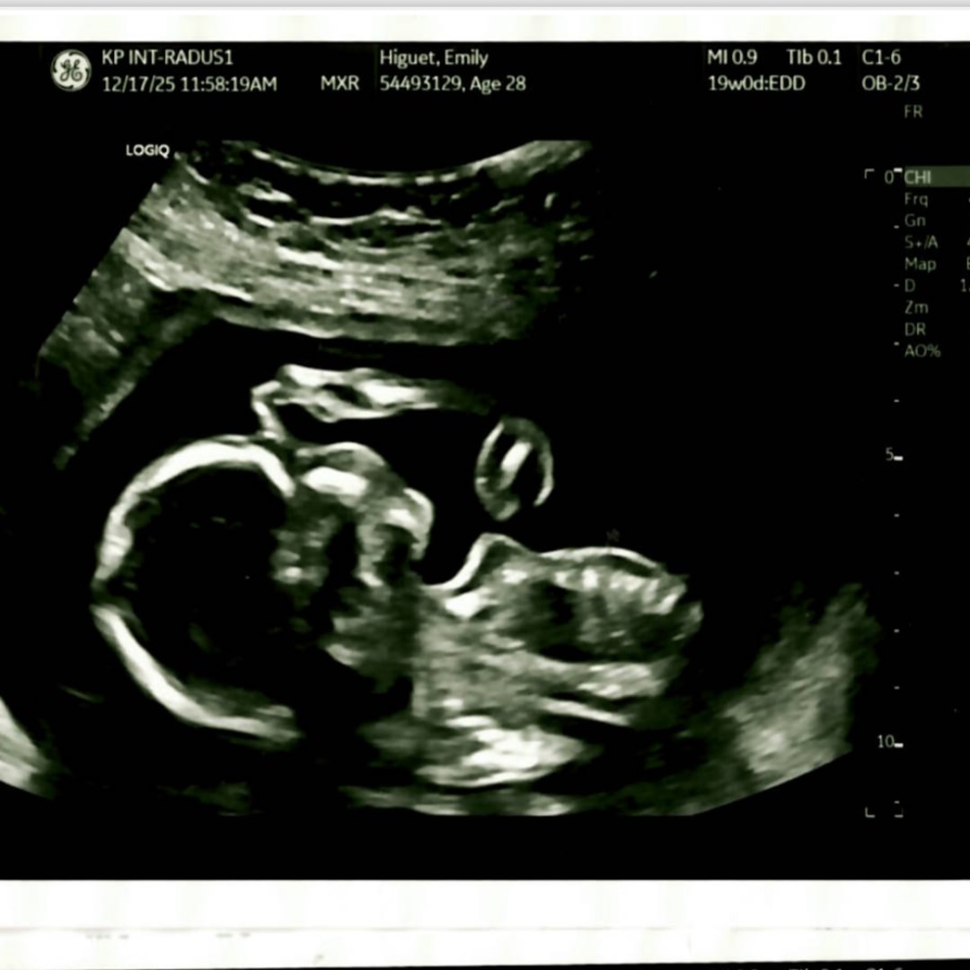 Photo shared by Emily for their Babylist baby registry.