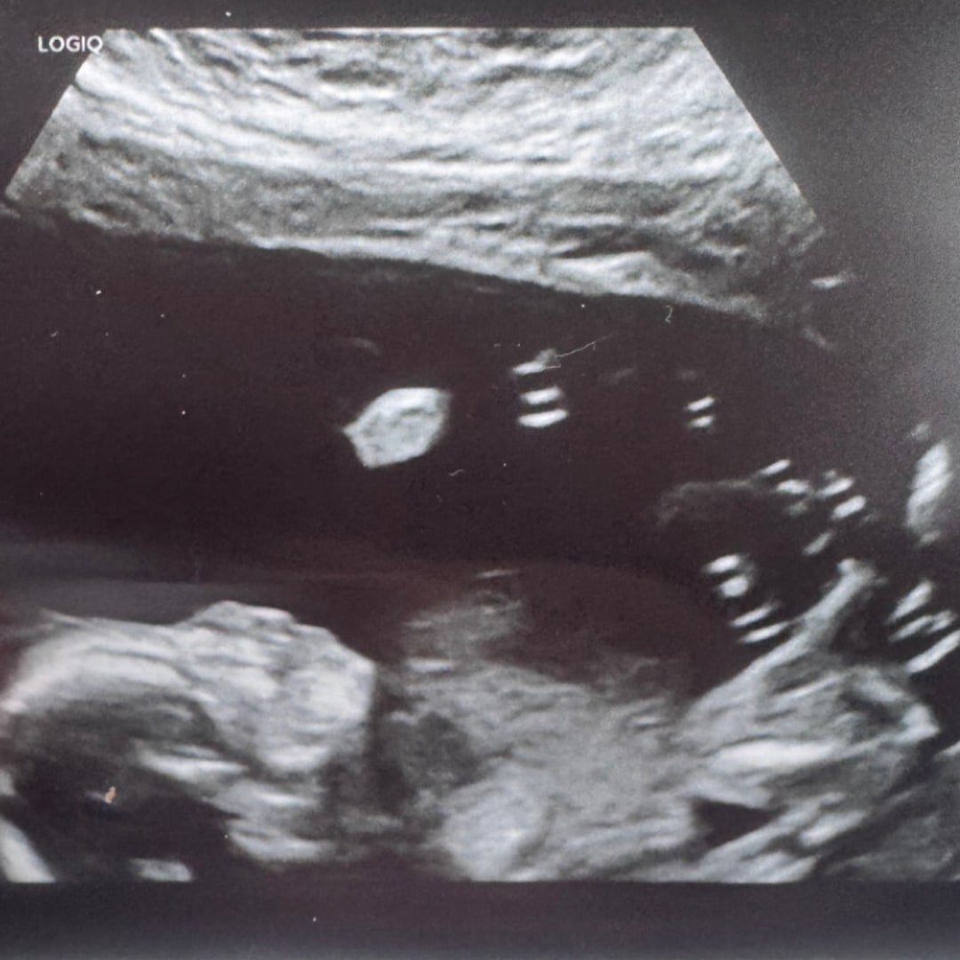 Photo shared by Raegan for their Babylist baby registry.