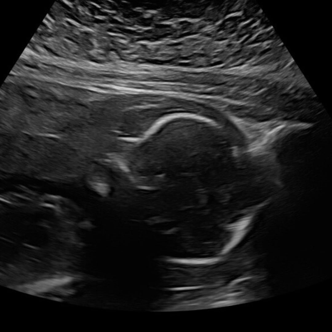 Photo shared by Julianna for their Babylist baby registry.